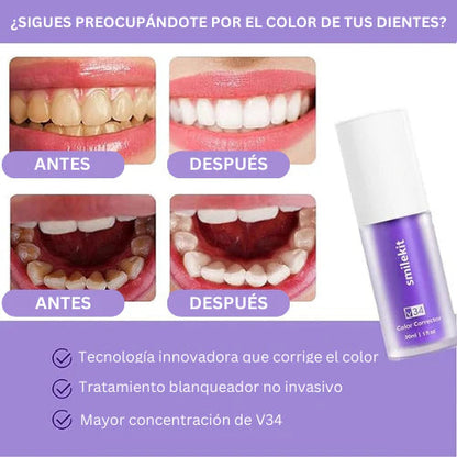 SmileKit Blanqueador Dental - TRENDFINDER® (2024) ⭐⭐⭐⭐⭐